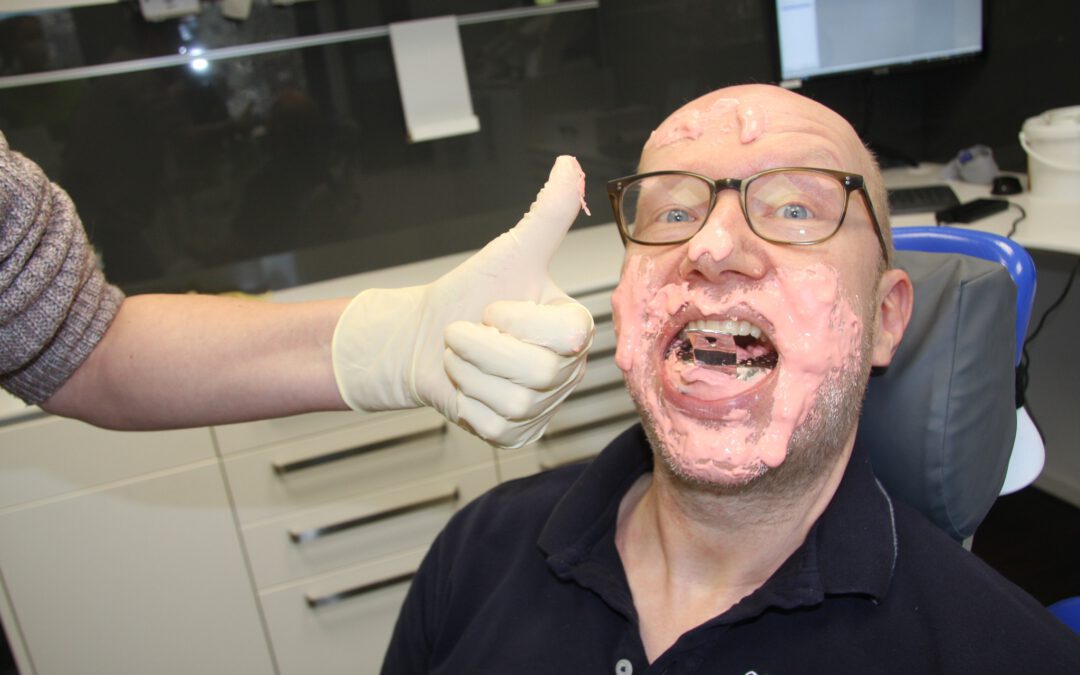 Intraoralscanner für Zahnabdrücke